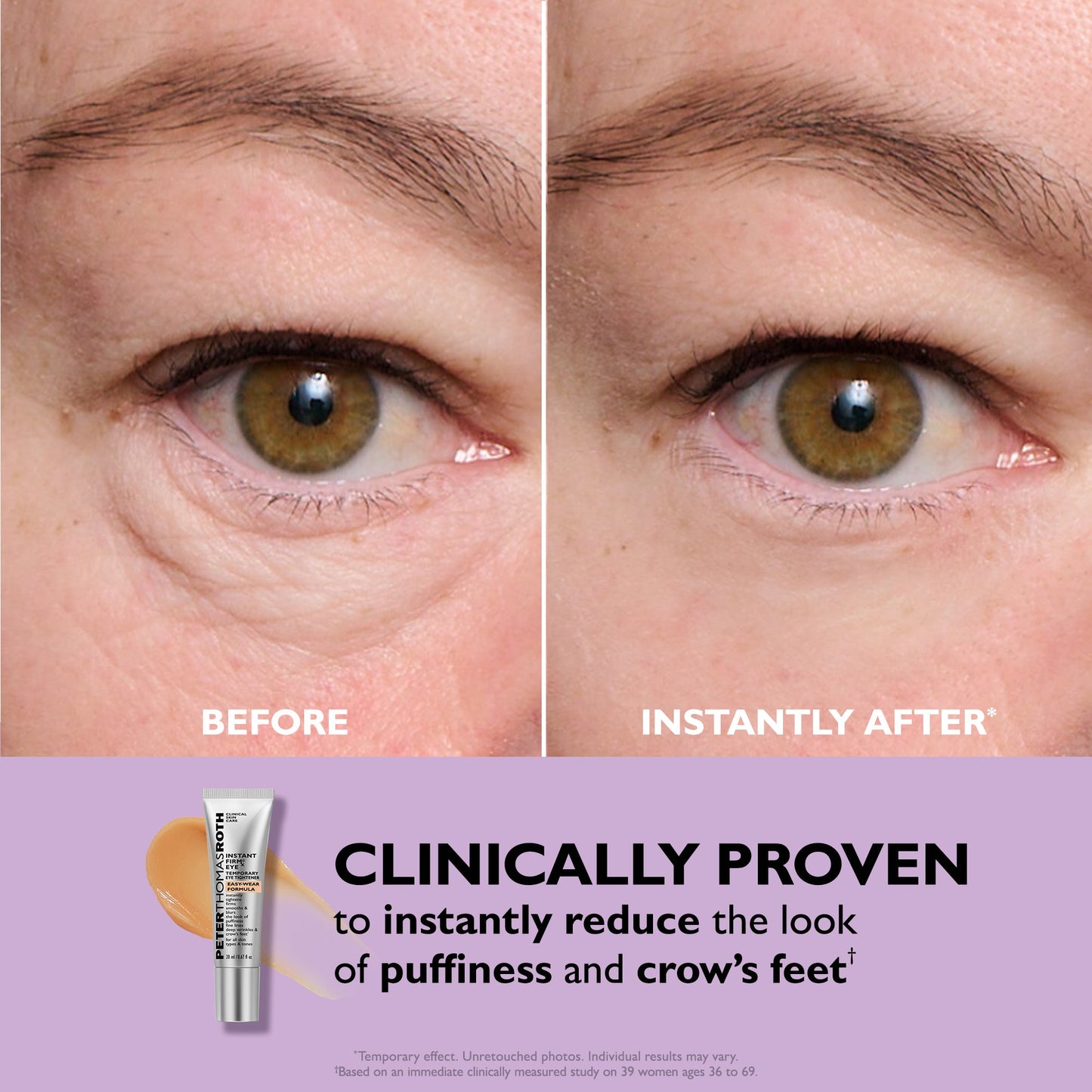 Peter Thomas Roth Instant FIRMx Eye | Eye Tightener