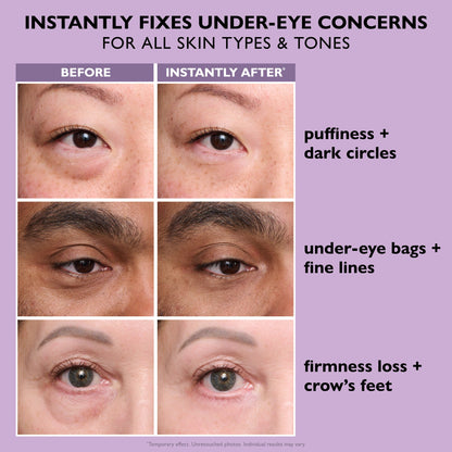 Peter Thomas Roth Instant FIRMx Eye | Eye Tightener